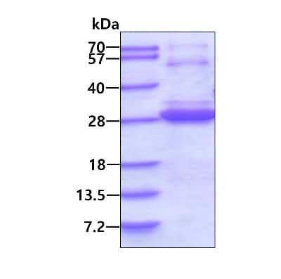 SDS-PAGE: Recombinant Human LSM12 His Protein [NBP2-23201]